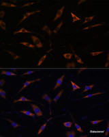 Immunofluorescence analysis of L929 cells using RPL28 Polyclonal Antibody at dilution of 1:100. Blue: DAPI for nuclear staining.