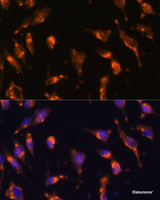 Immunofluorescence analysis of L929 cells using SSTR2 Polyclonal Antibody at dilution of 1:100 (40x lens) . Blue: DAPI for nuclear staining.