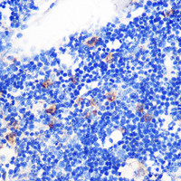 Immunohistochemistry of paraffin-embedded Rat bone marrow using TGFB1 Polyclonal Antibody at dilution of 1:100 (40x lens) .
