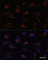 Immunofluorescence analysis of C6 cells using TGFB1 Polyclonal Antibody at dilution of 1:100. Blue: DAPI for nuclear staining.