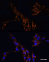 Immunofluorescence analysis of NIH/3T3 cells using TGFB1 Polyclonal Antibody at dilution of 1:100. Blue: DAPI for nuclear staining.