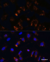 Immunofluorescence analysis of U2OS cells using TGFB1 Polyclonal Antibody at dilution of 1:100. Blue: DAPI for nuclear staining.