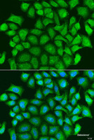 Immunofluorescence analysis of U2OS cells using TRAF3 Polyclonal Antibody at dilution of 1:100. Blue: DAPI for nuclear staining.