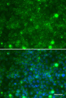 Immunofluorescence analysis of MCF-7 cells using TIMP3 Polyclonal Antibody