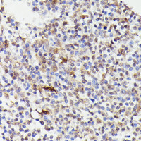 Immunohistochemistry of paraffin-embedded Human tonsil using CDC23 Polyclonal Antibody at dilution of 1:100 (40x lens) .