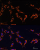 Immunofluorescence analysis of C6 cells using KSR1 Polyclonal Antibody at dilution of 1:100 (40x lens) . Blue: DAPI for nuclear staining.