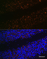 Immunofluorescence analysis of Rat brain using SLC17A6 Polyclonal Antibody at dilution of 1:100 (40x lens) . Blue: DAPI for nuclear staining.