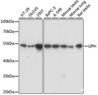 Western blot analysis of extracts of various cell lines using LIPH Polyclonal Antibody at dilution of 1:1000.
