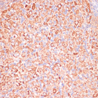 Immunohistochemistry of paraffin-embedded Rat ovary using ATP5C1 Polyclonal Antibody at dilution of 1:100 (40x lens) .