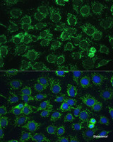 Immunofluorescence analysis of C6 cells using ATP5C1 Polyclonal Antibody at dilution of 1:100 (40x lens) . Blue: DAPI for nuclear staining.