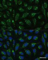 Immunofluorescence analysis of U-2 OS cells using ATP5C1 Polyclonal Antibody at dilution of 1:100 (40x lens) . Blue: DAPI for nuclear staining.