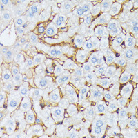 Immunohistochemistry of paraffin-embedded Mouse liver using CTNNA2 Polyclonal Antibody at dilution of 1:100 (40x lens) .