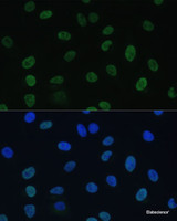 Immunofluorescence analysis of U-2 OS cells using GTF2E1 Polyclonal Antibody at dilution of 1:100 (40x lens) . Blue: DAPI for nuclear staining.