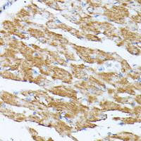 Immunohistochemistry of paraffin-embedded Rat heart using KCNJ15 Polyclonal Antibody at dilution of 1:100 (40x lens) .