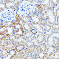 Immunohistochemistry of paraffin-embedded Mouse kidney using KCNJ15 Polyclonal Antibody at dilution of 1:100 (40x lens) .