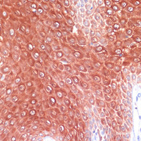 Immunohistochemistry of paraffin-embedded Human skin using S100A8 Polyclonal Antibody at dilution of 1:200 (40x lens) .