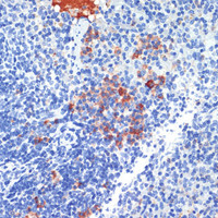 Immunohistochemistry of paraffin-embedded Mouse spleen using S100A8 Polyclonal Antibody at dilution of 1:200 (40x lens) .