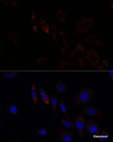 Immunofluorescence analysis of L929 cells using RNF112 Polyclonal Antibody at dilution of 1:100. Blue: DAPI for nuclear staining.