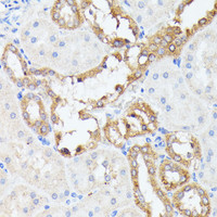 Immunohistochemistry of paraffin-embedded Rat kidney using PTP4A2 Polyclonal Antibody at dilution of 1:100 (40x lens) .