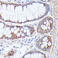 Immunohistochemistry of paraffin-embedded Human colon using PTP4A2 Polyclonal Antibody at dilution of 1:100 (40x lens) .