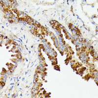 Immunohistochemistry of paraffin-embedded Mouse lung using PTP4A2 Polyclonal Antibody at dilution of 1:100 (40x lens) .
