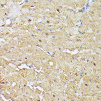 Immunohistochemistry of paraffin-embedded Rat heart using TRIP4 Polyclonal Antibody at dilution of 1:100 (40x lens) .