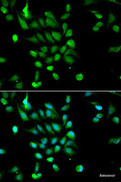 Immunofluorescence analysis of MCF-7 cells using PSMC5 Polyclonal Antibody