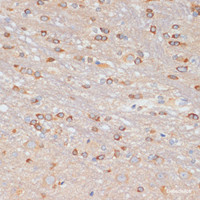 Immunohistochemistry of paraffin-embedded Rat brain using NFAT2 Polyclonal Antibody at dilution of 1:100 (40x lens) .