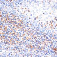 Immunohistochemistry of paraffin-embedded Human tonsil using NFAT2 Polyclonal Antibody at dilution of 1:100 (40x lens) .