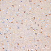 Immunohistochemistry of paraffin-embedded Mouse brain using NFAT2 Polyclonal Antibody at dilution of 1:100 (40x lens) .