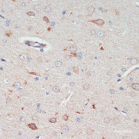 Immunohistochemistry of paraffin-embedded Rat brain using AFG3L2 Polyclonal Antibody at dilution of 1:200 (40x lens) .