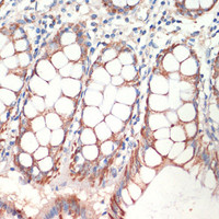 Immunohistochemistry of paraffin-embedded Human colon using AFG3L2 Polyclonal Antibody at dilution of 1:200 (40x lens) .