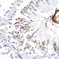 Immunohistochemistry of paraffin-embedded Rat testis using TNFR1 Polyclonal Antibody at dilution of 1:100 (40x lens) .