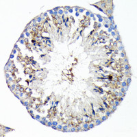 Immunohistochemistry of paraffin-embedded Mouse testis using TNFR1 Polyclonal Antibody at dilution of 1:100 (40x lens) .
