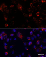 Immunofluorescence analysis of A431 cells using ACOT9 Polyclonal Antibody at dilution of 1:100. Blue: DAPI for nuclear staining.