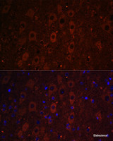 Immunofluorescence analysis of Mouse brain using RUSC1 Polyclonal Antibody at dilution of 1:100. Blue: DAPI for nuclear staining.
