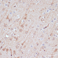 Immunohistochemistry of paraffin-embedded Rat brain using AK5 Polyclonal Antibody at dilution of 1:100 (40x lens) .