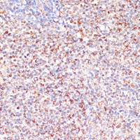 Immunohistochemistry of paraffin-embedded Human lymph node using MRPL46 Polyclonal Antibody at dilution of 1:100 (40x lens) .