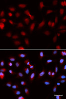 Immunofluorescence analysis of U2OS cells using Survivin Polyclonal Antibody