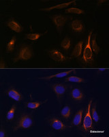 Immunofluorescence analysis of U-2 OS cells using VMP1 Polyclonal Antibody at dilution of 1:100 (40x lens) . Blue: DAPI for nuclear staining.