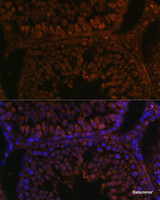 Immunofluorescence analysis of Rat testis using TPD52L3 Polyclonal Antibody at dilution of 1:100. Blue: DAPI for nuclear staining.