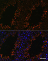 Immunofluorescence analysis of Mouse testis using TPD52L3 Polyclonal Antibody at dilution of 1:100. Blue: DAPI for nuclear staining.
