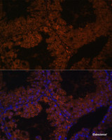 Immunofluorescence analysis of Mouse testis using TPD52L3 Polyclonal Antibody at dilution of 1:100. Blue: DAPI for nuclear staining.