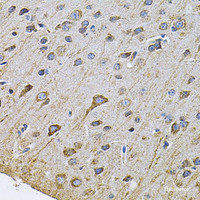 Immunohistochemistry of paraffin-embedded Rat brain using DRD3 Polyclonal Antibody at dilution of 1:100 (40x lens) .