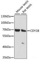 Western blot analysis of extracts of various cell lines using CDY1B Polyclonal Antibody at dilution of 1:1000.