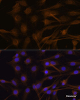 Immunofluorescence analysis of C6 cells using TIMP2 Polyclonal Antibody at dilution of 1:100. Blue: DAPI for nuclear staining.