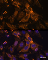 Immunofluorescence analysis of U-2 OS cells using TIMP2 Polyclonal Antibody at dilution of 1:100. Blue: DAPI for nuclear staining.