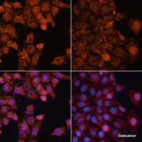 Immunofluorescence analysis of HeLa cells using LC3A / LC3B Polyclonal Antibody at dilution of 1:100. Hela cells were treated by Chloroquine (50 μM) for 20 hours (left) . Blue: DAPI for nuclear staining.