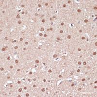 Immunohistochemistry of paraffin-embedded Rat brain using ITCH Polyclonal Antibody at dilution of 1:100 (40x lens) .