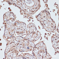 Immunohistochemistry of paraffin-embedded Human placenta using ITCH Polyclonal Antibody at dilution of 1:100 (40x lens) .